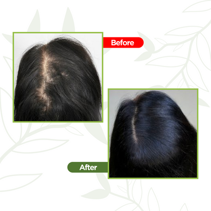 Anti Hair Fall & Hair Growth Oil - BLEND OF 7 OILS & 33+ HERBS - 110 ML