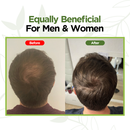 Anti Hair Fall & Hair Growth Oil - BLEND OF 7 OILS & 33+ HERBS - 110 ML